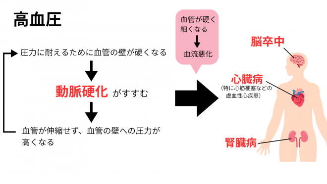 高血圧の図